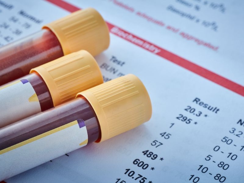 Essential Health Tests for Individuals Over 60